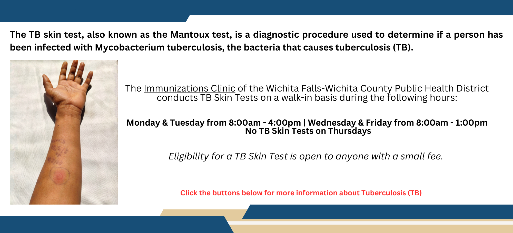 Subpage_TB Skin Test