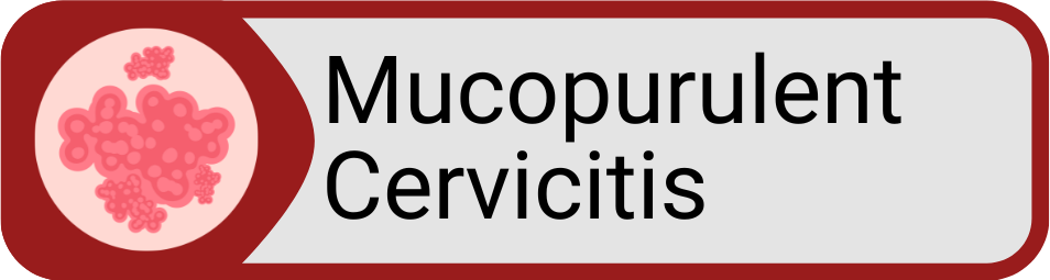 Button Mucopurulent Cervicitis